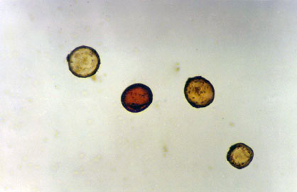 Mycorrhizal spores isolated from Sudan Grass.